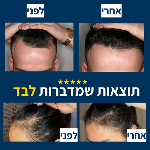 תמונות לפני ואחרי של שיער הראש